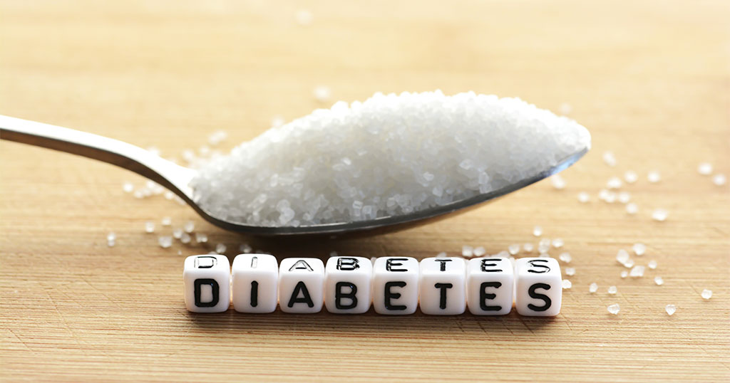 Is diabetes causing your vision problems?