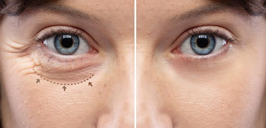 Oculoplastic Surgery: Enhancing Vision and Appearance