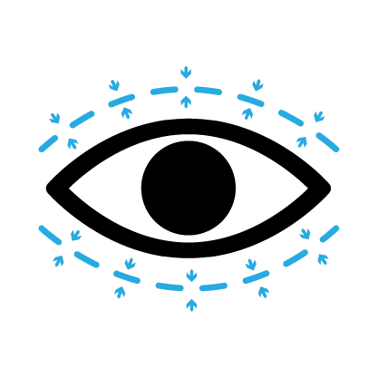 Oculoplastics
